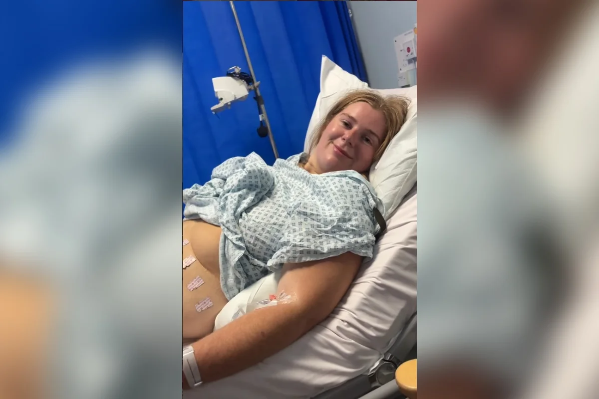 Mulher quase m0rre por sepse após espremer pelo encravado na virilha