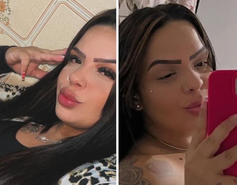 Mulher de 28 anos m0rre dias após extrair dente do siso, diz família