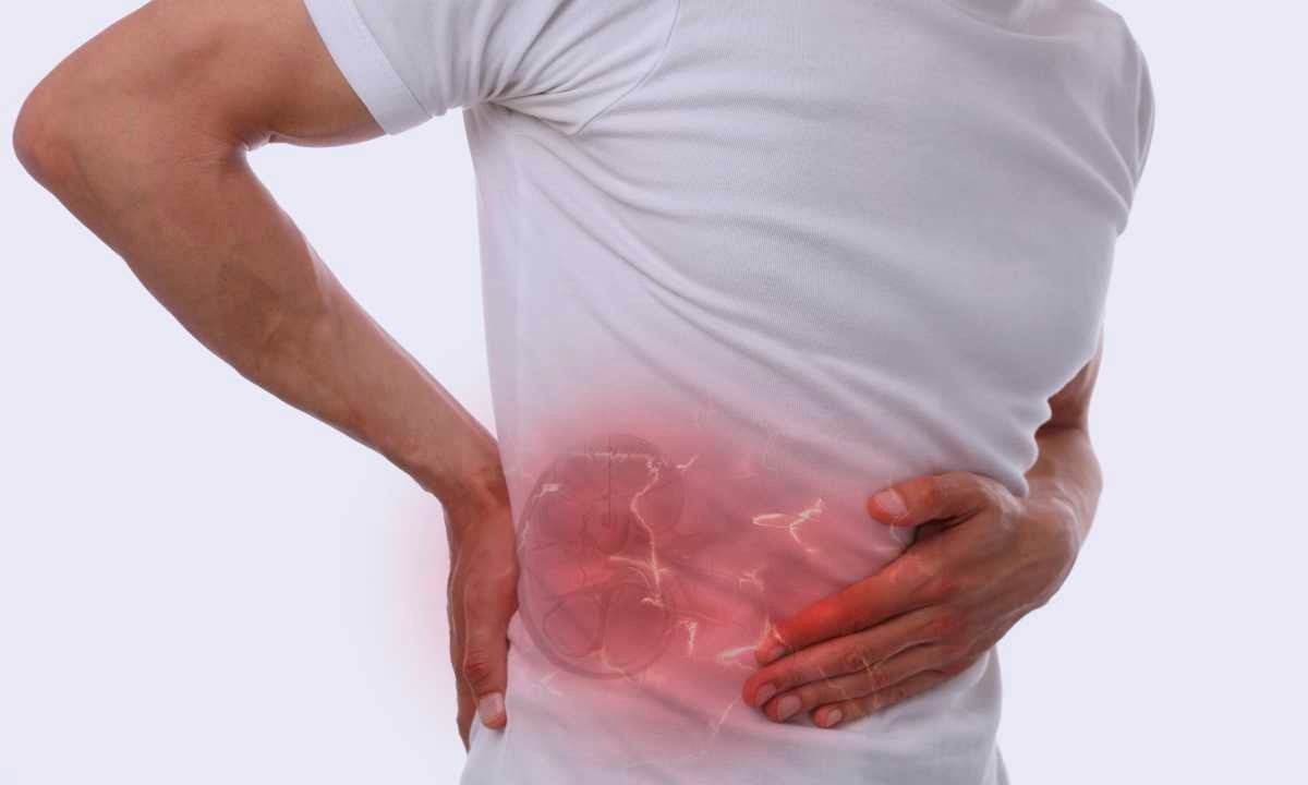 8 sintomas que você pode está com pedras nos rins e o que fazer